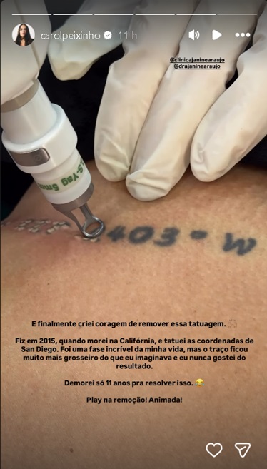 Carol Peixinho mostra processo de remoção de tatuagem após 11 anos - Foto: Instagram 