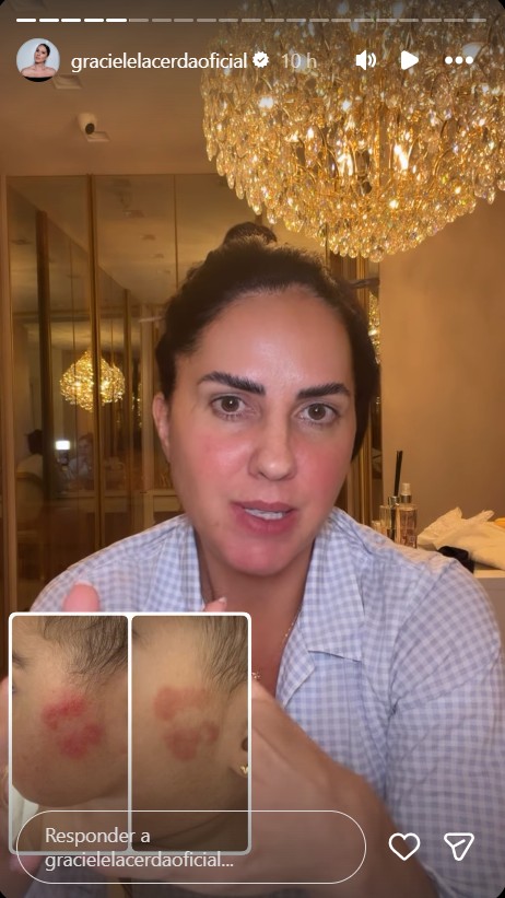 Graciele Lacerda exibe mancha no rosto da filha - Foto: Reprodução / Instagram @gracielelacerdaoficial 