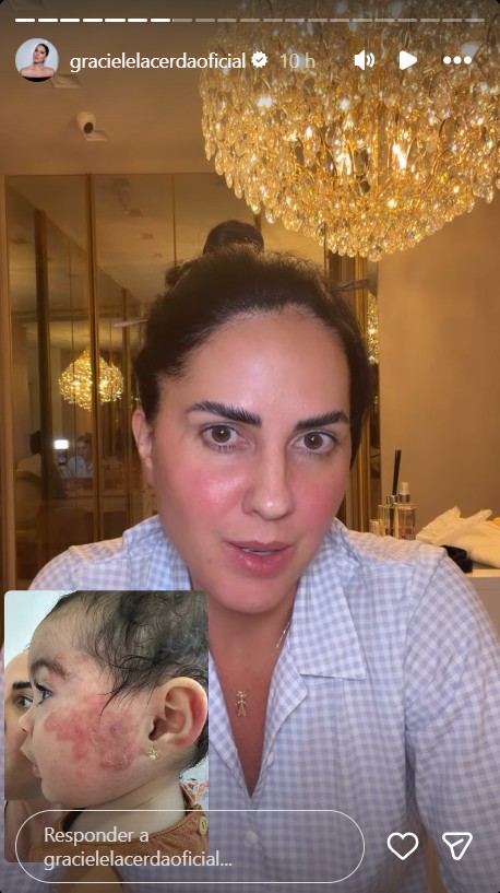 Graciele Lacerda exibe mancha no rosto da filha - Foto: Reprodução / Instagram @gracielelacerdaoficial 