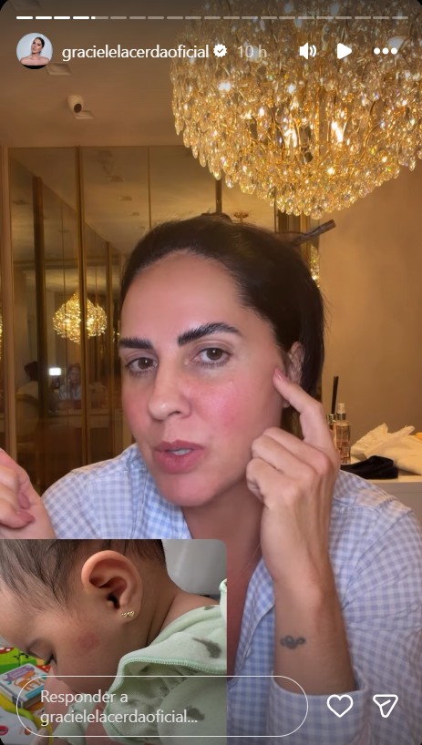 Graciele Lacerda exibe mancha no rosto da filha - Foto: Reprodução / Instagram @gracielelacerdaoficial 