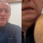 Jornalista da Globo mostra ferimentos após ser atacado por pitbull: ‘Tomei quatro pontos’