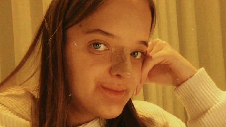 Após mais de um mês de cirurgia, Rafaella Justus explica sumiço na rede social: ‘Muito’