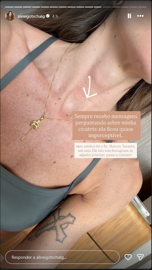 Storie Aline Gotschalg - Foto: Reprodução/Instagram