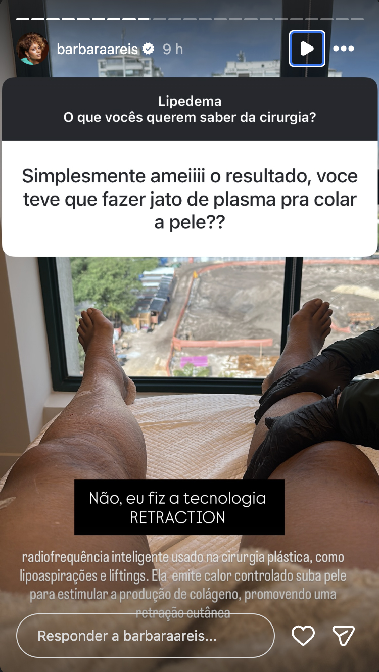 Post de Bárbara Reis - Foto: Reprodução / Instagram