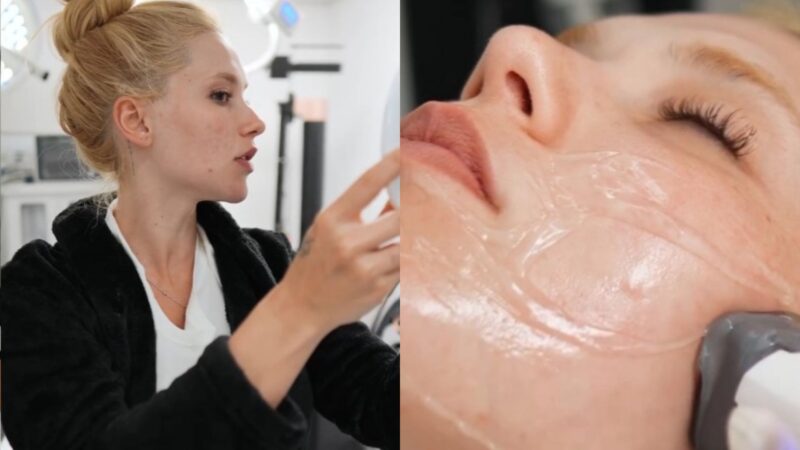 Virginia Fonseca investe em tratamento facial de alta tecnologia; saiba qual