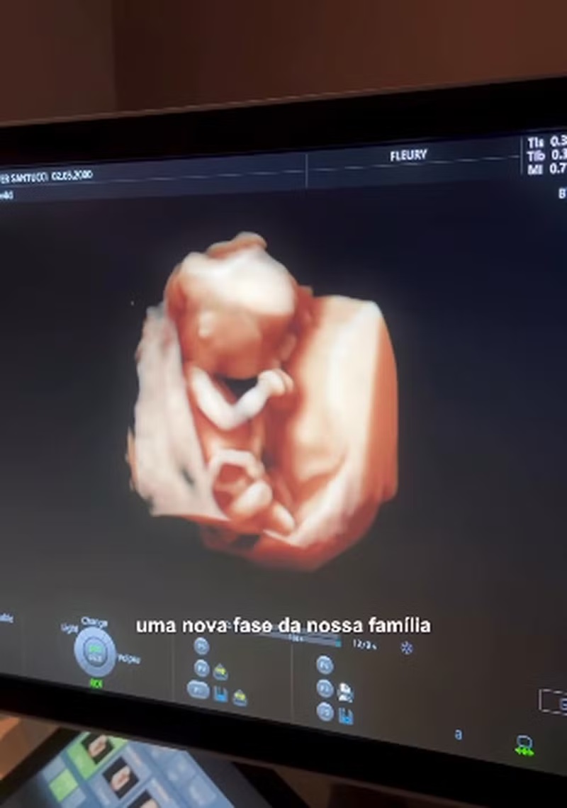 Jheny Santucci espera  mais um filho de Arthur Aguiar — Foto: Reprodução/Instagram