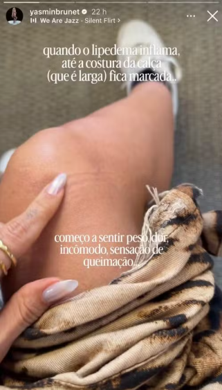 Storie Yasmin Brunet - Foto: Reprodução/Instagram