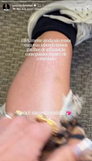Storie Yasmin Brunet - Foto: Reprodução/Instagram