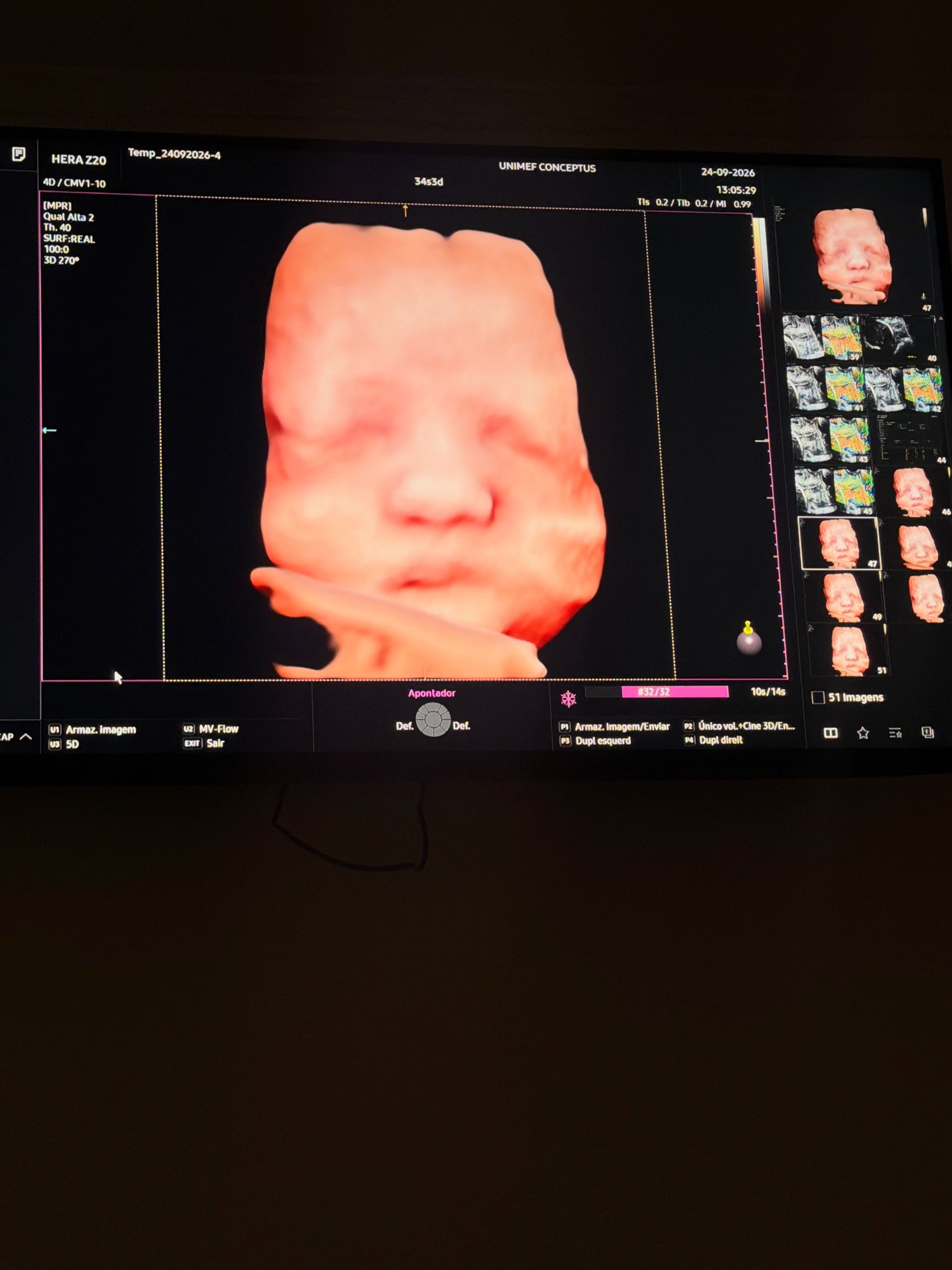Ultrassom da filha de Júlia Vieira e Luigi César - Foto: Reprodução / Instagram