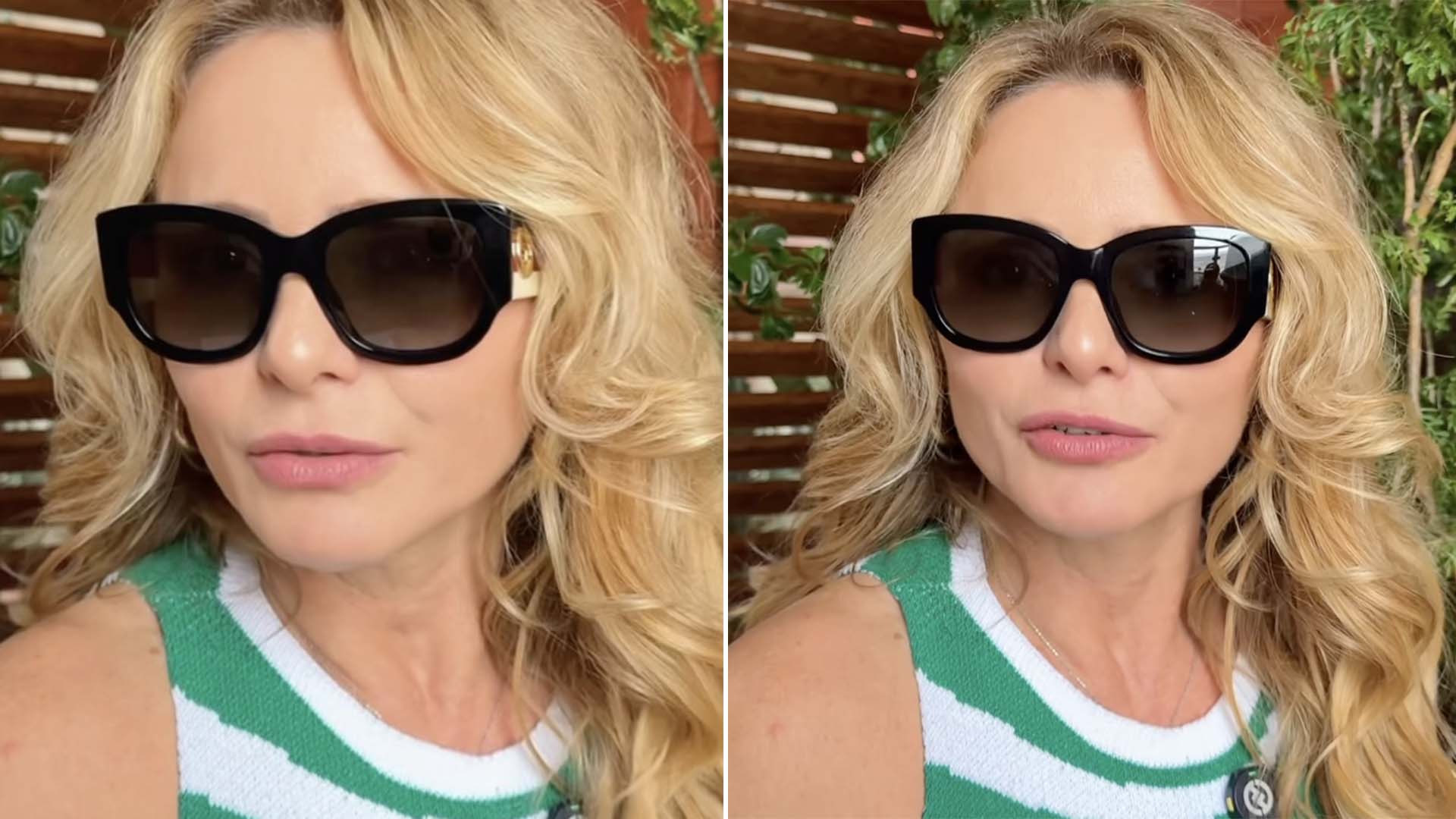 Por que Rita Guedes continua de &oacute;culos escuros? Erro m&eacute;dico, inflama&ccedil;&atilde;o e sequela no caso da atriz