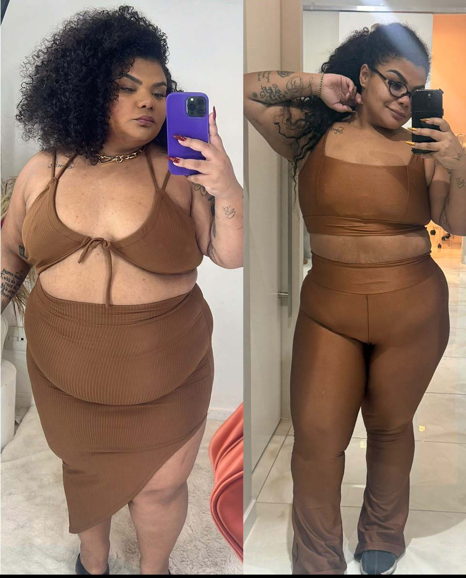 Antes e depois do emagrecimento de Flora Cruz - Foto: Divulgação