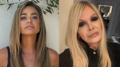 Denise Richards e Monique Evans reacendem interesse pelo lifting facial; médico explica diferenças entre técnicas