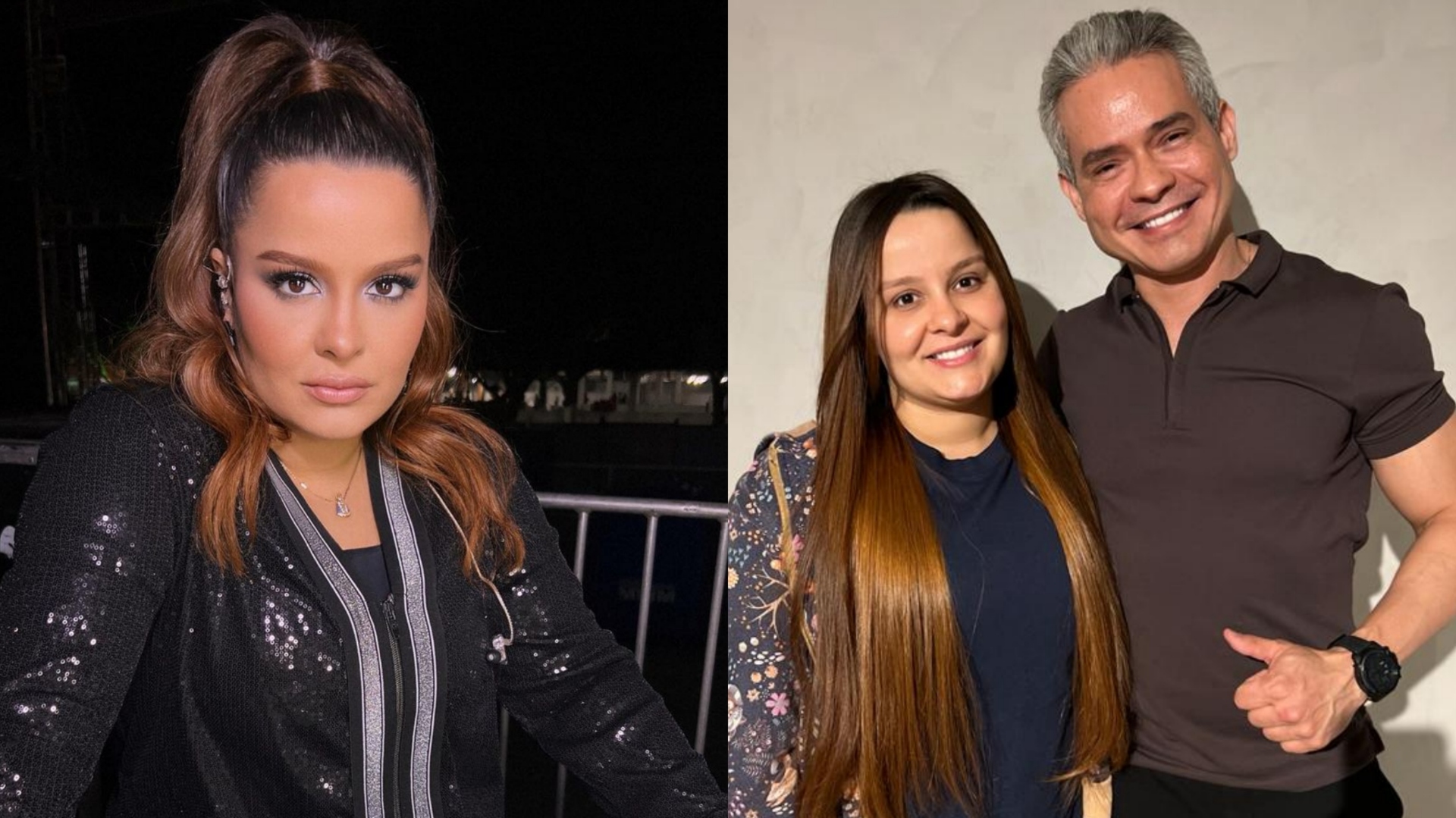 Alopecia: sertaneja Maiara segue tratamento com dermatologista para prevenir queda de cabelo