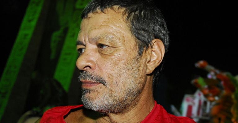 Sócrates: balão gástrico é retirado