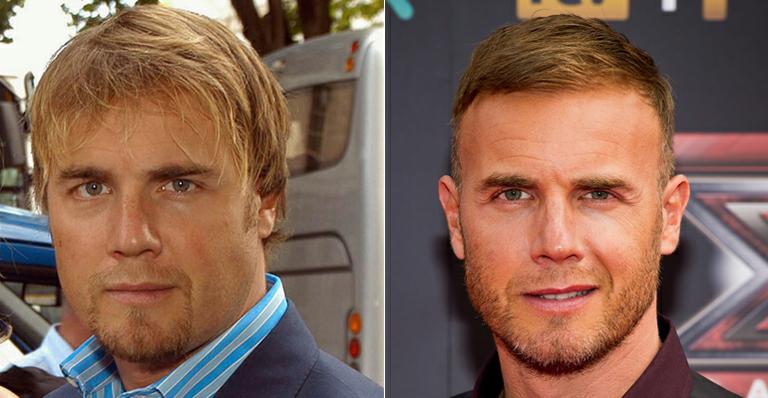 Gary Barlow perdeu 30kg: ‘era depressão’