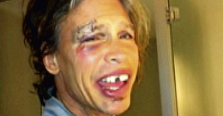 Steven Tyler perde dois dentes após cair durante o banho
