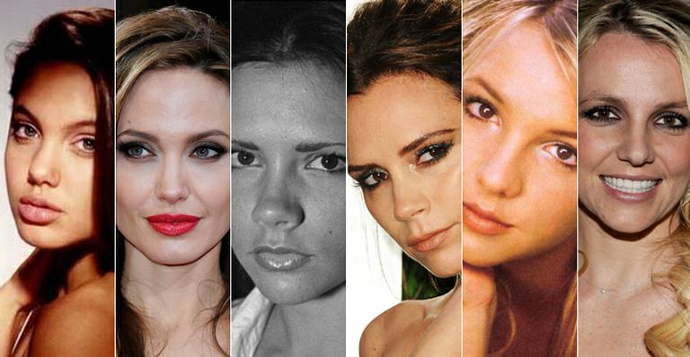 Celebridades antes e depois da plástica: quais delas mudaram o nariz?