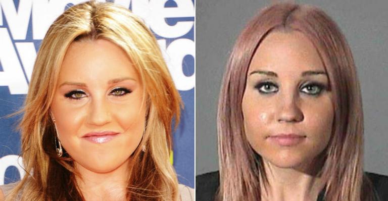 Amanda Bynes é diagnosticada com esquizofrenia e transtorno bipolar