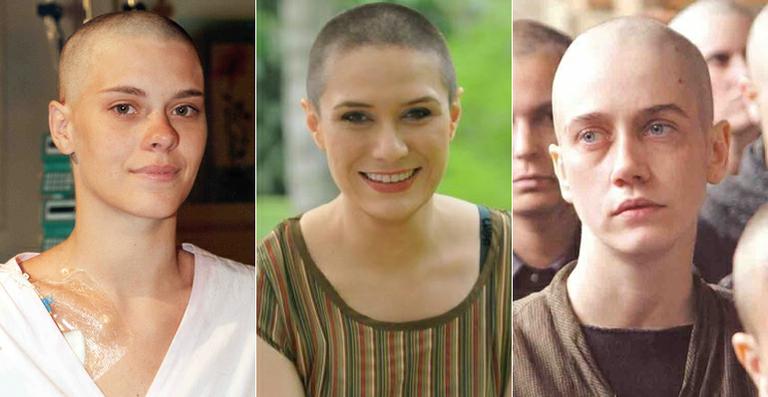 Relembre as famosas que já ficaram carecas