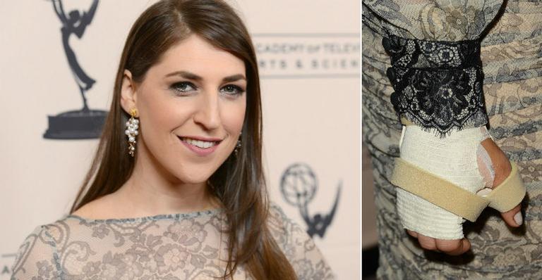 Mayim Bialik volta ao tapete vermelho após acidente de carro