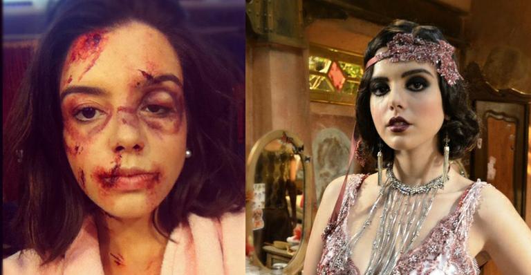 ‘Gabriela’: Giovanna Lancellotti mostra caracterização de Lindinalva após agressão