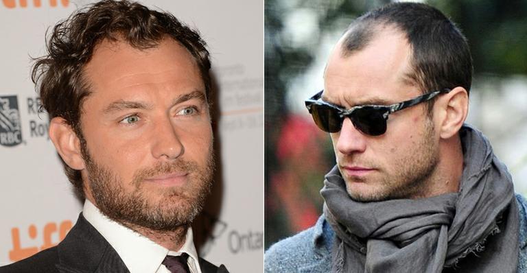 Tabloide britânico sugere que Jude Law fez transplante capilar