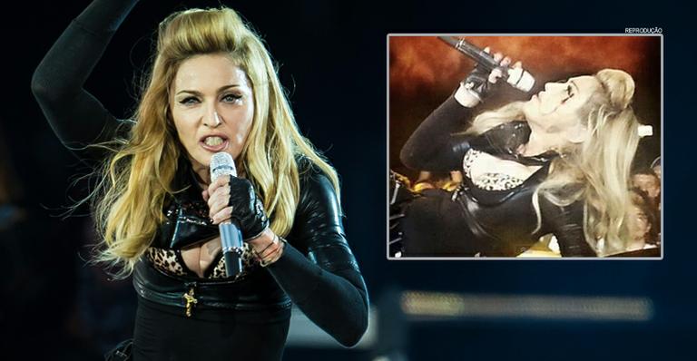Madonna leva soco no rosto e termina show na Colômbia sangrando