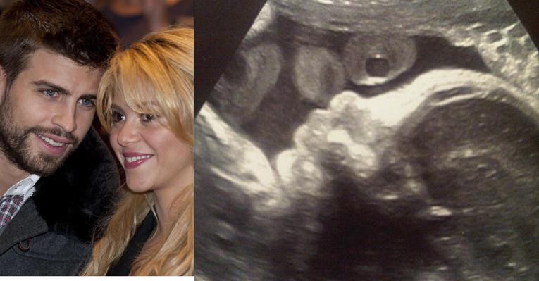 Gerard Piqué divulga imagem do ultrassom de seu filho com Shakira