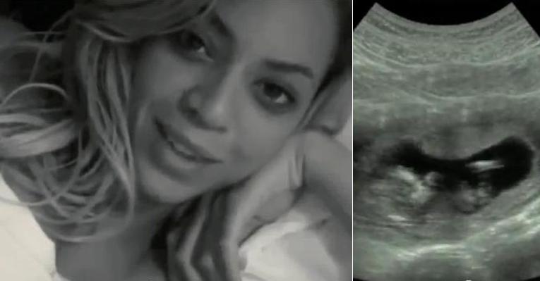 Os truques de Beyoncé para suportar as dores do parto