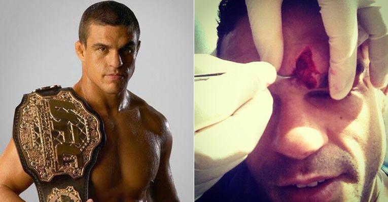 “Sem sacrifício não há vitória”, diz Vitor Belfort depois de se machucar em treino