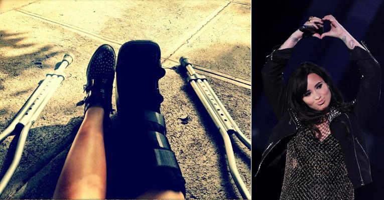 Acidente doméstico: Demi Lovato cai e quebra a perna