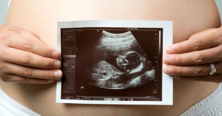 Festa do ultrassom é o novo chá de bebê entre mães americanas