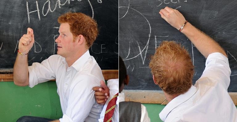 Príncipe Harry também está ficando careca