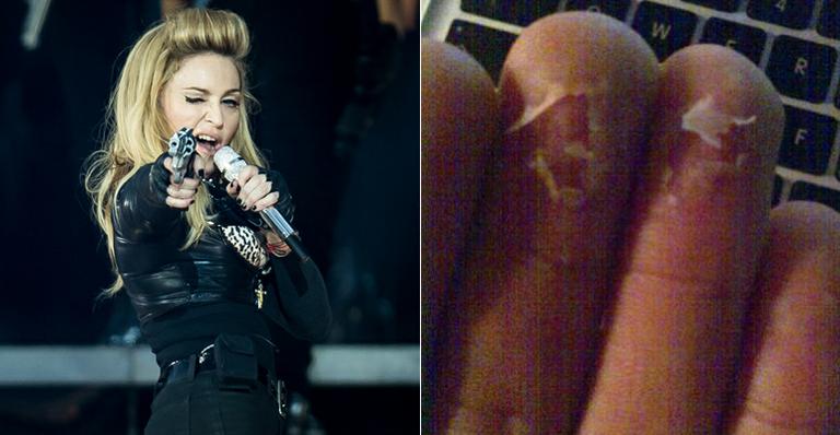Madonna divulga foto dos dedos esfolados do editor do novo DVD da cantora