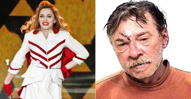 Irmão mendigo de Madonna leva nove pontos no rosto após briga com policial