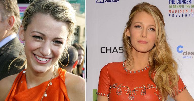 Blake Lively revela o truque de seus cabelos ondulados