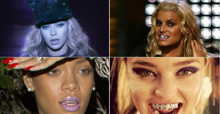 Febre entre as famosas, grillz pode causar desgaste e até fraturas nos dentes, afirma especialista
