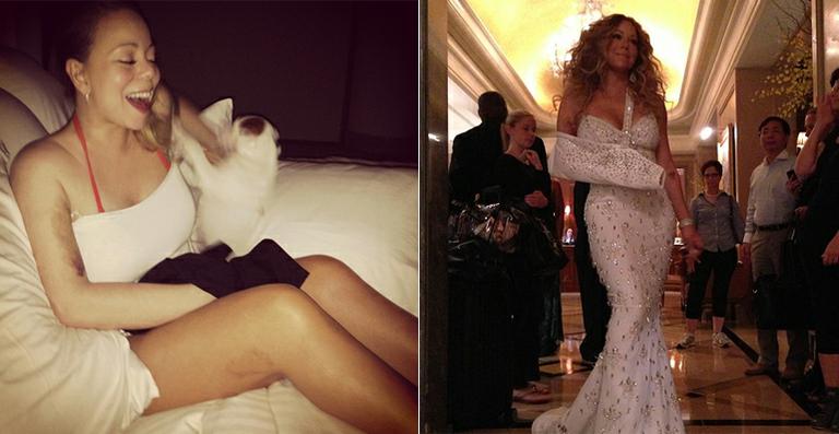 Mariah Carey tira a tipoia e mostra hematoma em seu braço