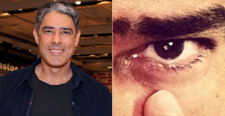 William Bonner passa bem após cirurgia e já pode voltar ao trabalho na segunda-feira
