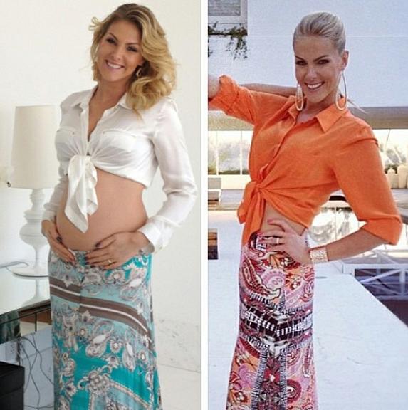 Ana Hickmann mostra antes e depois da gravidez: ‘Quanta diferença de cintura’