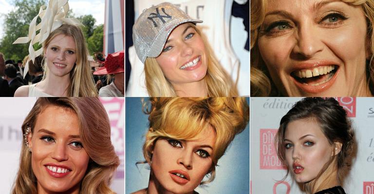 Sorriso imperfeito: as famosas que fazem sucesso com os dentes separados