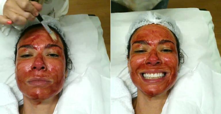 Luciana Gimenez faz tratamento facial e mostra vídeo na internet