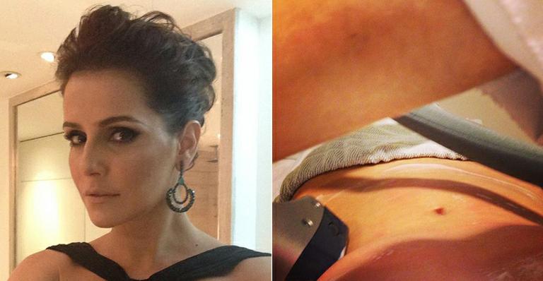Projeto verão: Deborah Secco começa a semana em clínica de estética