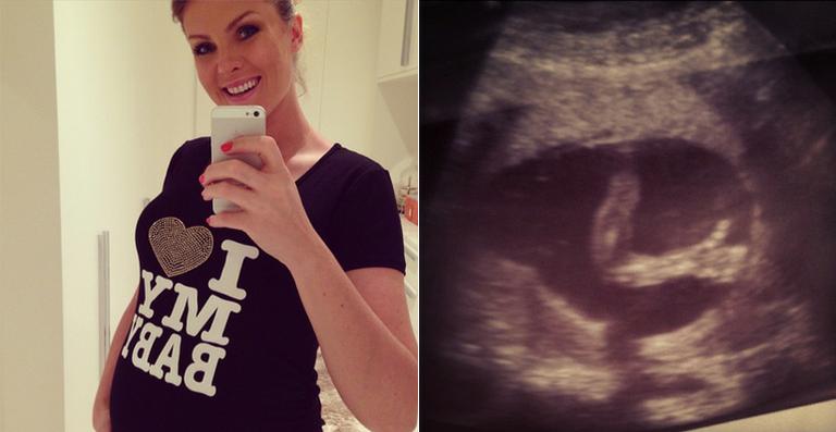 Ana Hickmann fica encantada com ultrassom do filho em que ele faz o sinal de positivo