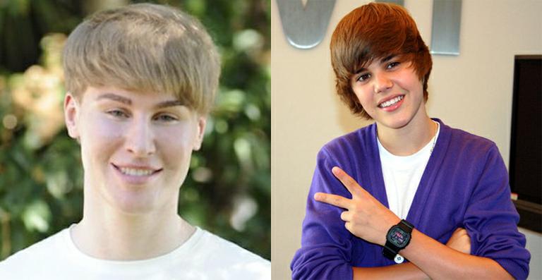 Homem gasta US$ 100 mil em cirurgias para ficar parecido com Justin Bieber