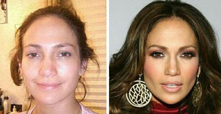 Cirurgião diz que Jennifer Lopez fez plástica, mas cantora nega