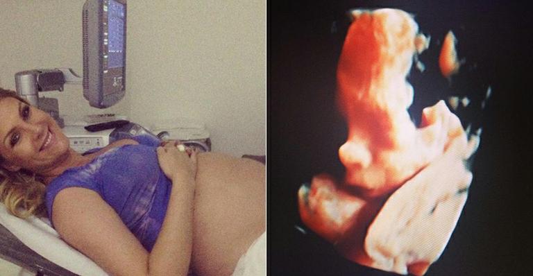 Ana Hickmann mostra ultrassom com o rosto do bebê: “Imagem mais linda do mundo”