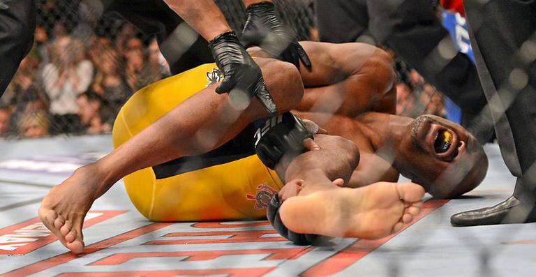 Famosos lamentam lesão de Anderson Silva, que quebrou a perna no UFC 168