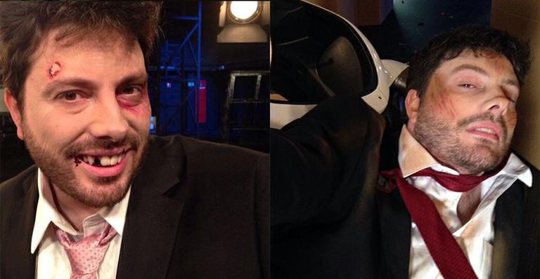 Danilo Gentili aparece com ‘hematomas’ em foto nos bastidores de gravação
