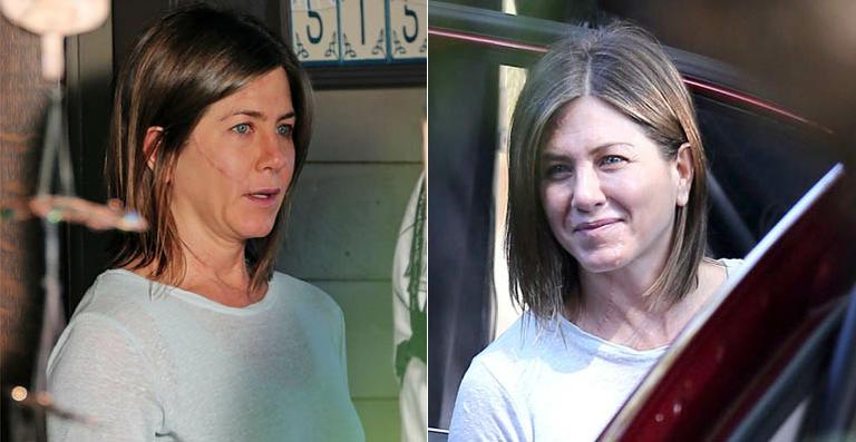 Jennifer Aniston aparece com cicatrizes no rosto em set